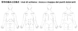 背中の痛みと圧痛点:mal di schiena:moxa e mappa dei punti doloranti